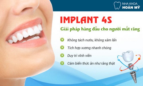 Ưu điểm vượt trội của cấy ghép răng Implant 4S là gì?5