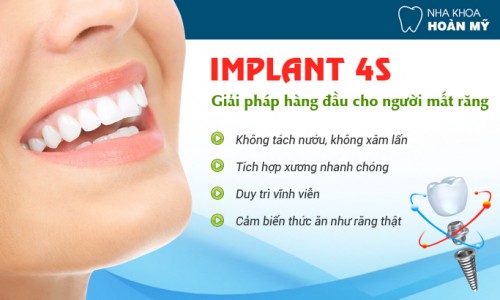 Dùng Implant để trồng răng cửa giá bao nhiêu 4