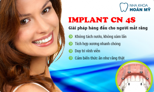 Trồng răng ở đâu thì tốt và đẹp nhất? Trồng răng ở đâu thì tốt và đẹp nhất 8