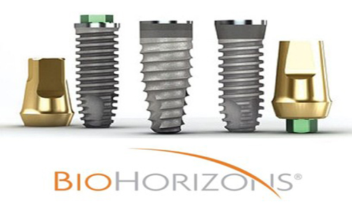 Thông tin về các loại trụ Implant hữu ích nhất cho bạn 3