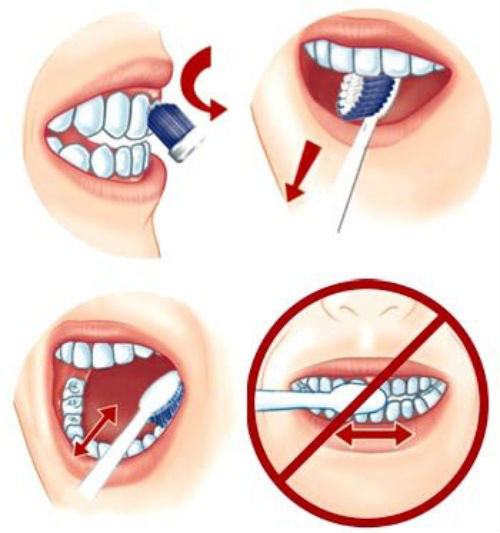 Cách giảm ê buốt răng
