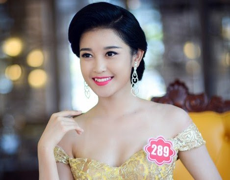 Trồng răng khểnh