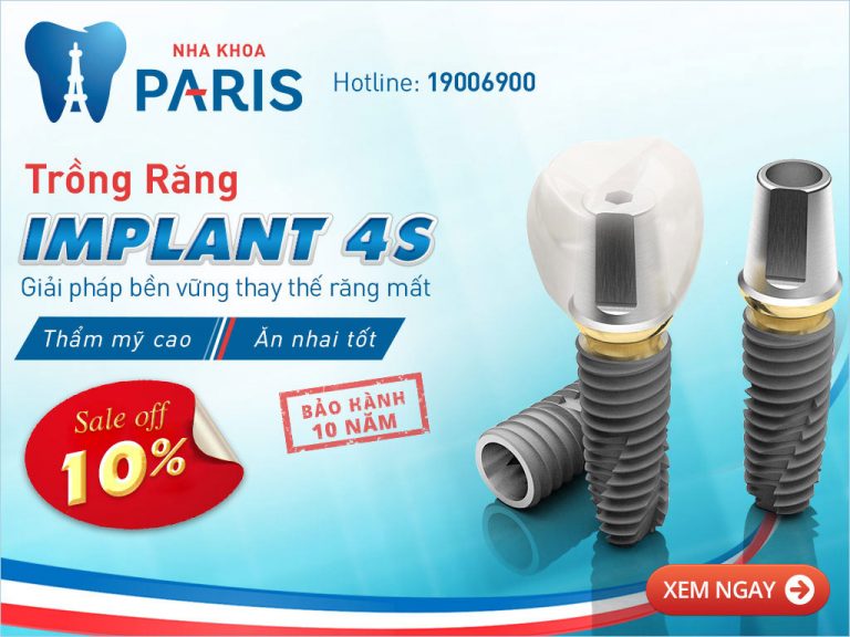 Cấy ghép răng implant