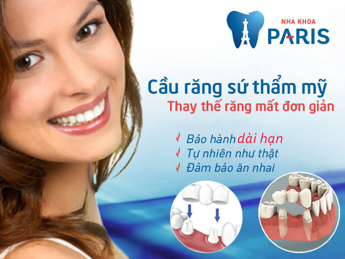 Làm cầu răng sứ thẩm mỹ