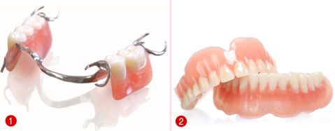 Hàm răng giả tháo lắp - BẢNG GIÁ & QUY TRÌNH thực hiện! Hàm răng giả tháo lắp và các thông tin hữu ích bạn cần biết 2