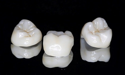 [Câu hỏi thường gặp] giá trồng răng giả các loại hết bao nhiêu tiền? 1