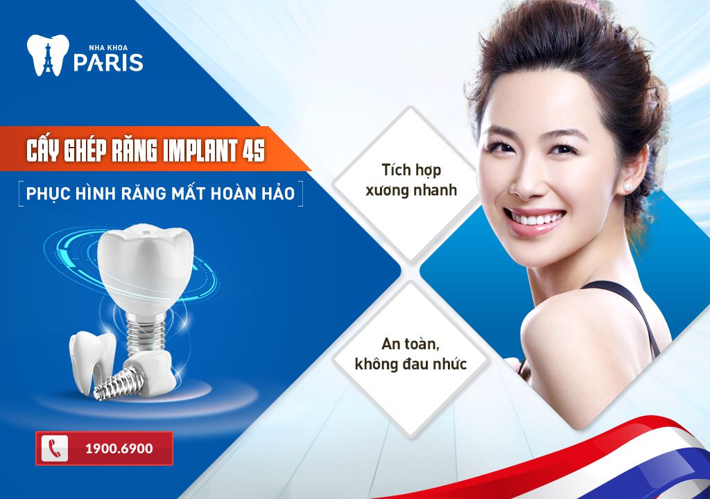 4 Nguyên nhân cấy ghép implant bị thất bại và cách khắc phục