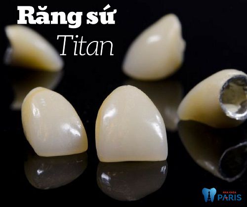 Trồng răng sứ Titan và 5 điều bạn nhất định phải biết!